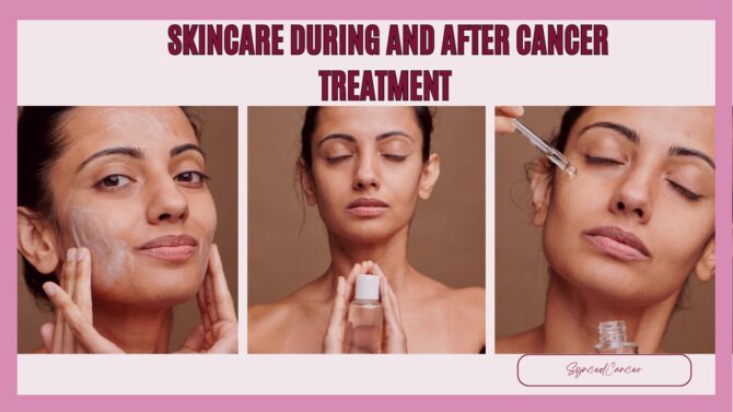 Skincare Cancer treatment